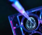 Maladie d’Alzheimer : des ultrasons pour éliminer les plaques bêta-amyloïdes