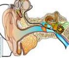 Audition : un nouveau type d'implants cochléaires sur le marché d'ici quelques années