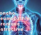 Bronchopneumopathie chronique obstructive : une mutation génétique confirmée comme facteur de prédisposition