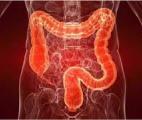 Cancer colorectal : l'intelligence artificielle permet de caractériser les polypes