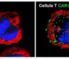 Cancer : comment prolonger l'efficacité des CAR-T cells ?