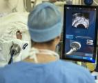 Cancer de la prostate : une nouvelle approche pour éviter les biopsies inutiles