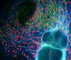 Cancer : découverte d'un nouveau mécanisme qui bloque les cellules malignes