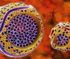 Cancer du pancréas : une nouvelle thérapie japonaise à base de nanocapsules