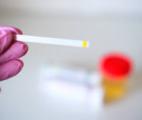 Cancer du rein : un test urinaire pour réduire de moitié les scanners