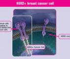 Cancer du sein : l'association de deux molécules anti HER2 ouvre une nouvelle voie thérapeutique