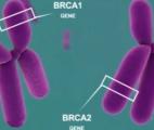 Cancer du sein : le gène BRCA2 cartographié
