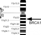 Cancer du sein: le mécanisme génétique d'action du gène BCRA1 enfin compris
