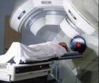 Cancer du sein : vers une radiothérapie préventive ?