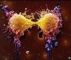 Cancer : la voie prometteuse de l'élimination des cellules-souches