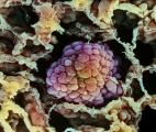 Cancer : Le taux de survie global continue à progresser au Japon