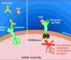 Cancer : les inhibiteurs de kinases élargissent leur champ thérapeutique