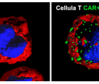 Cancer : un nouveau traitement français basé sur CART-cells