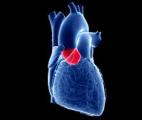 Cardiawave, soigner son cœur avec des ultrasons
