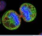 Comment deux structures cellulaires coopèrent pour permettre la dissémination tumorale