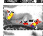 Comment le cerveau humain reconnaît un visage