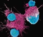 De nouvelles cellules CAR-T permettent de contrôler à la demande le traitement contre le cancer