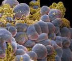 Déclencher l'apoptose de manière contrôlée : une voie prometteuse contre le cancer