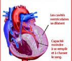 Découverte d’un nouveau mécanisme moléculaire de l’insuffisance cardiaque