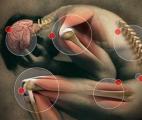 Découverte d'un nouveau récepteur dans la voie de signalisation de la douleur