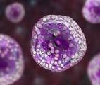 Des «avatars» pour traiter le lymphome de manière personnalisée