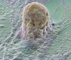 Des cellules pulmonaires humaines obtenues à partir de cellules souches