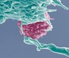Des chercheurs découvrent un nouveau lymphocyte pour tuer des cellules cancéreuses