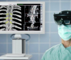 Des chirurgiens utilisent HoloLens pour mieux planifier les biopsies