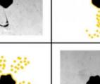 Des microbulles contrôlées par une pince acoustique pour un largage ultra-localisé de médicaments