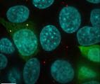 Des microprotéines pour bloquer la croissance tumorale