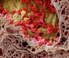 Des nanoparticules capables de cibler et tuer des cellules cancéreuses