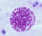 Des nanoparticules de pommes de terre contre la toxoplasmose !