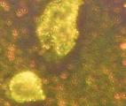Des nanoparticules d’or inversent les symptômes dans la sclérose en plaques et la maladie de Parkinson