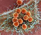 Des scientifiques gallois ont découvert une cellule qui s'attaque à tous les cancers