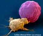 Des scientifiques mettent au point des cellules -tueuses- de cancer