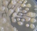 Détecter les bactéries dans les liquides à l’aide d'un simple gel