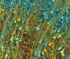 Le cerveau dévoile de nouveaux océans de complexité...