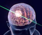 Les ondes lumineuses et sonores sont en train de révolutionner la science et la médecine