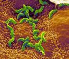 Eradiquer Helicobacter pylori pour réduire le risque de cancer de l'estomac chez certains patients