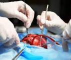Greffes : un rein de porc transplanté pour la première fois sur un patient vivant