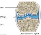 Innovation : premier cartilage artificiel assez performant pour restaurer les genoux