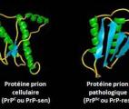 La maladie d'Alzheimer est-elle une maladie à prion ?