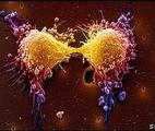 La mortalité par cancer poursuit sa décrue historique aux Etats-Unis