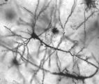 La neurogenèse tout au long de la vie prouvée grâce aux essais nucléaires