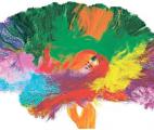 La taille de certaines régions du cerveau est corrélée avec l’intensité des relations sociales