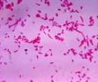 Le cancer colorectal est-il provoqué par une bactérie ?