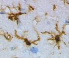Le rôle des microglies mieux compris dans la maladie d’Alzheimer