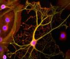 Les astrocytes auraient permis l'évolution cérébrale unique de l'espèce humaine