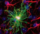 Les astrocytes joueraient un rôle déterminant dans la mort des neurones…