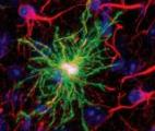 Les astrocytes seraient impliqués dans la dépression